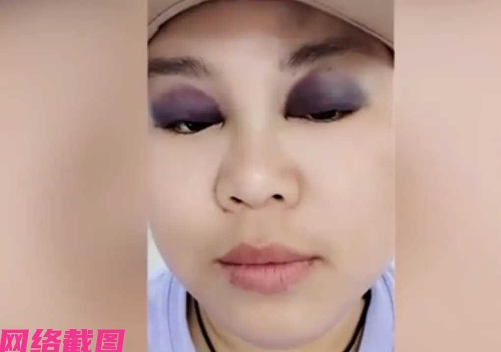 广东汕头有夫妻两人在床上打闹，只是中途还发生意外，女子把自己撞到了床头而完造成自