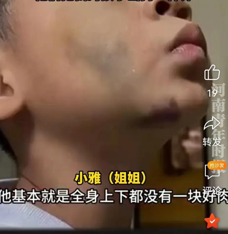 丧尽天良，字字血泪！湖南武冈的丁女士爆料，自己离婚后由生父抚养的一对儿女，长期遭