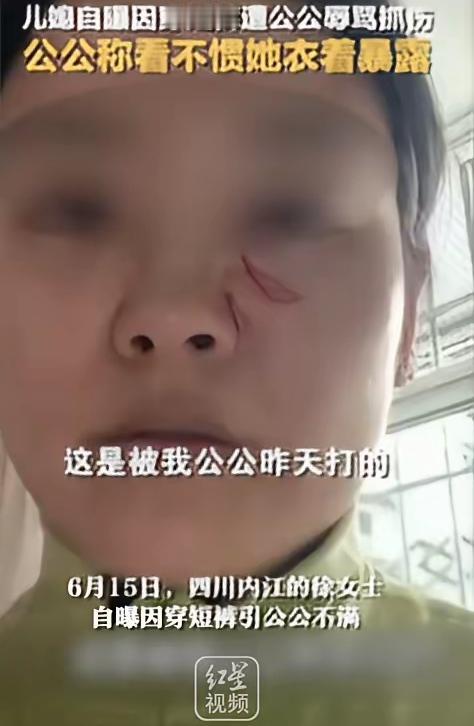 一条居家短裤，撕开了多少大家庭藏在和睦外表下的边界问题。四川内江天气闷热，徐女士