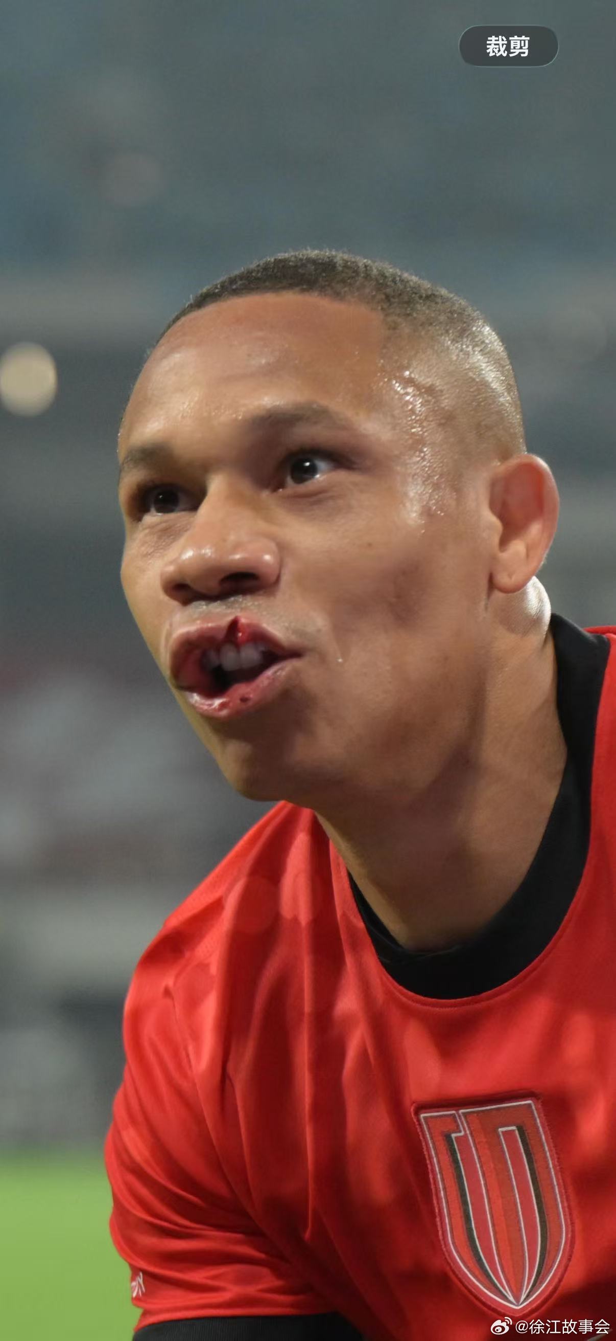 席尔瓦这个嘴破的，看着都疼，我的妈，真疼！ 