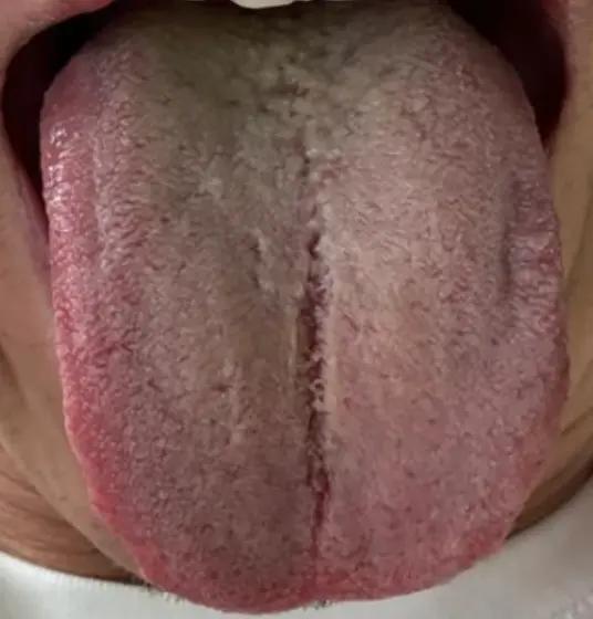 心里想法多，床上软趴趴，有心补一补，奈何补品吃不起[大哭]
要我说，补品确实是贵