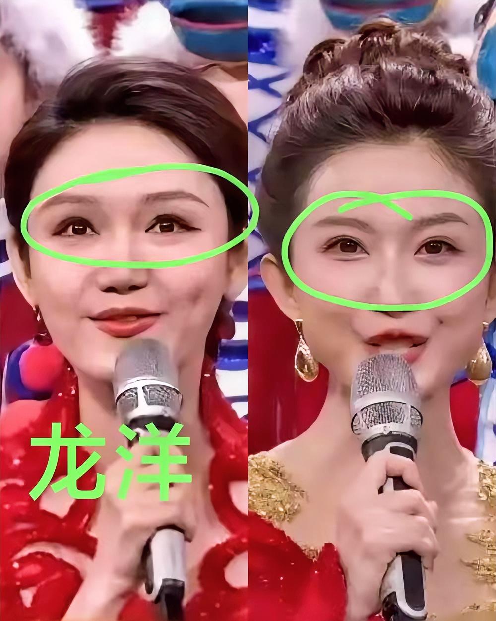 2026马年央视春晚后，主持人龙洋因眼神问题成了热议焦点。她主持时眼睛总不自觉往