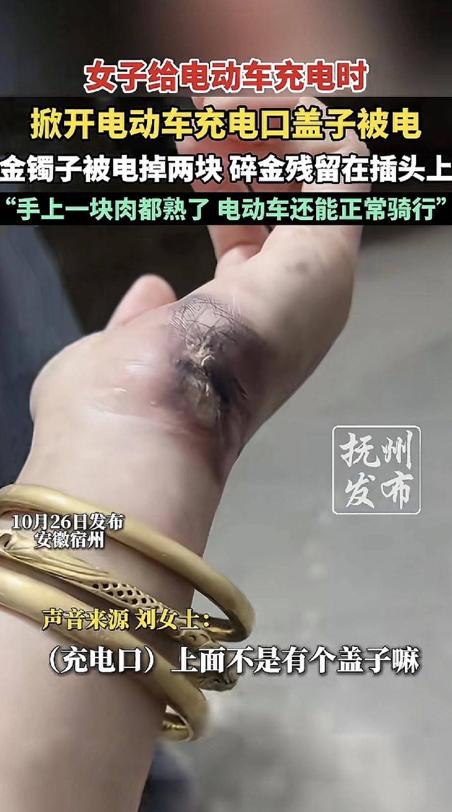 这事儿太吓人了！一位女士给电动车充电时，随手掀开充电口的盖子，没想到当场被电击—