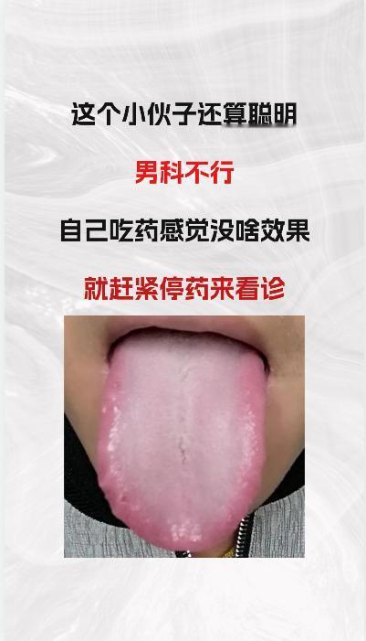 看这个小伙，还怪聪明里，男科不行，吃了补肾药没有效果，就赶紧停药来看病