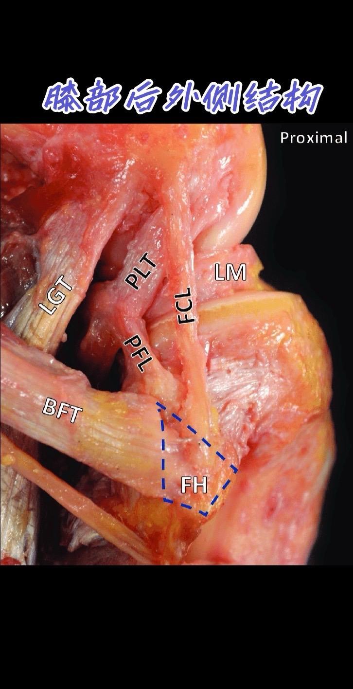 膝部后外侧结构。