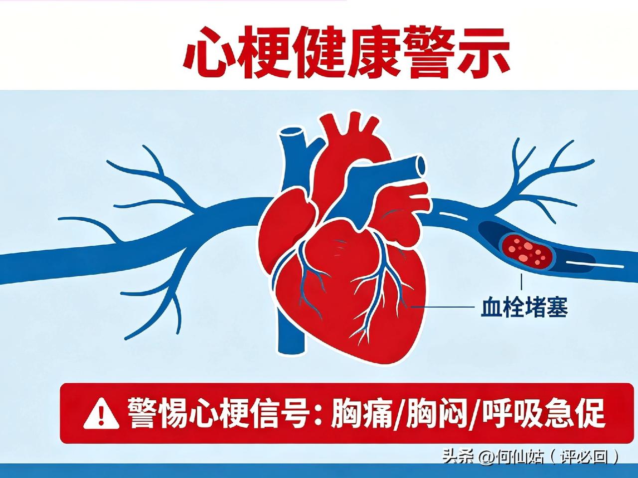 警惕！身体出现这几种信号！
可能是心梗前兆！
 比心绞痛更凶险的是“沉默性心梗