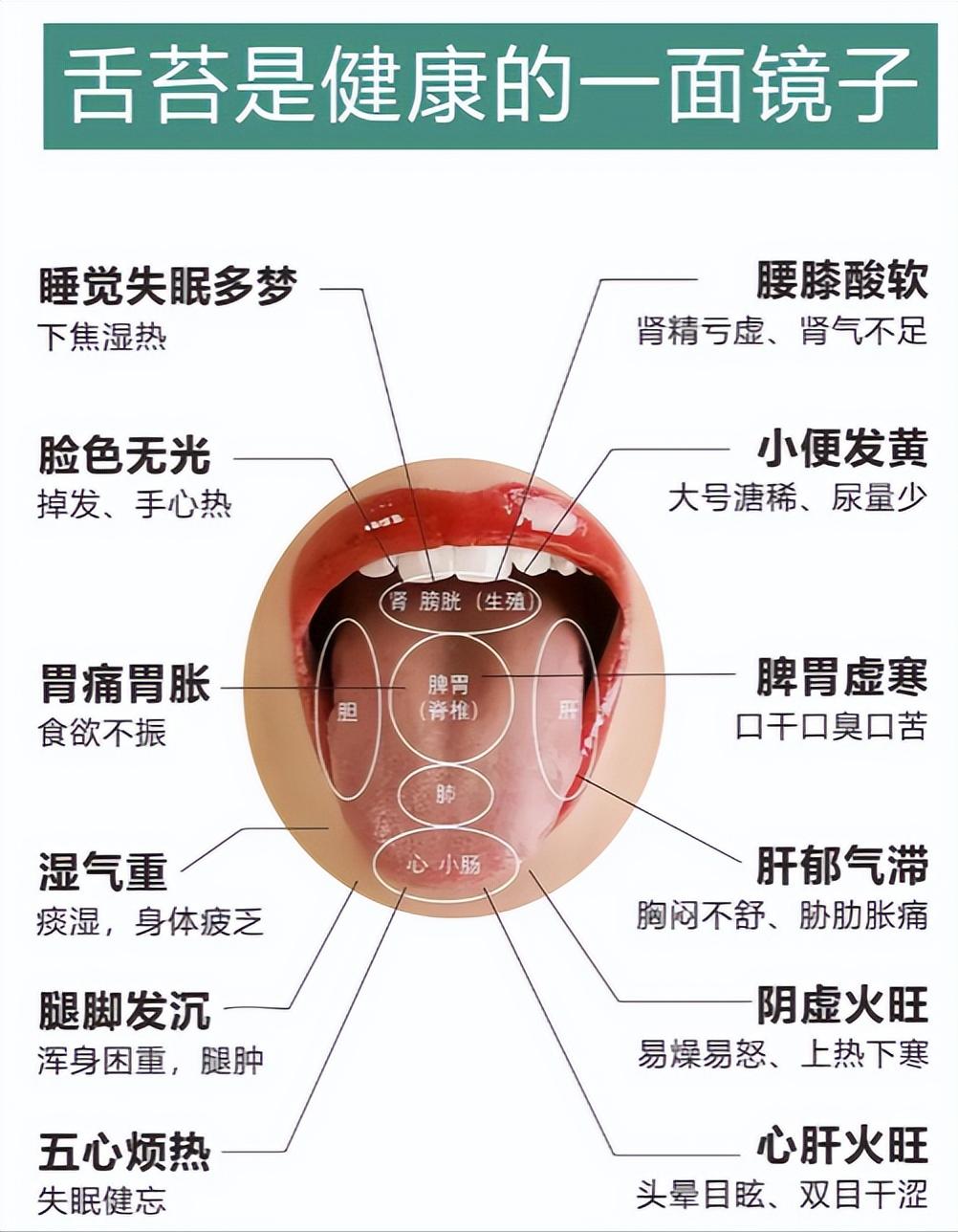 今日舌诊挑战，只要你发过来，我就直接告诉你结果！

不懂的身体情况，就不要乱补一