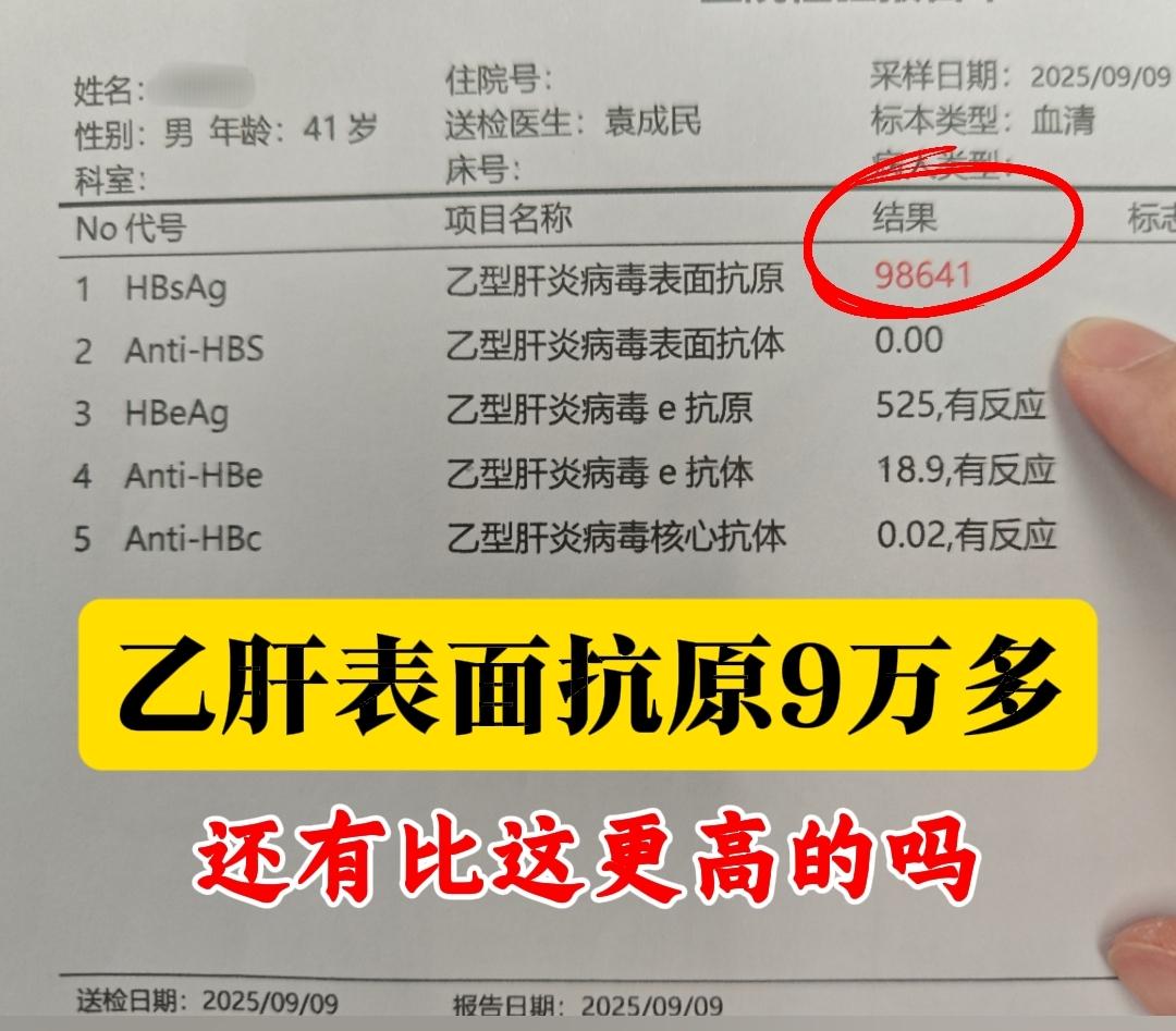 这是昨天专家门诊上一位菏泽患者的检查单，目前表面抗原已经到了9万多。虽...