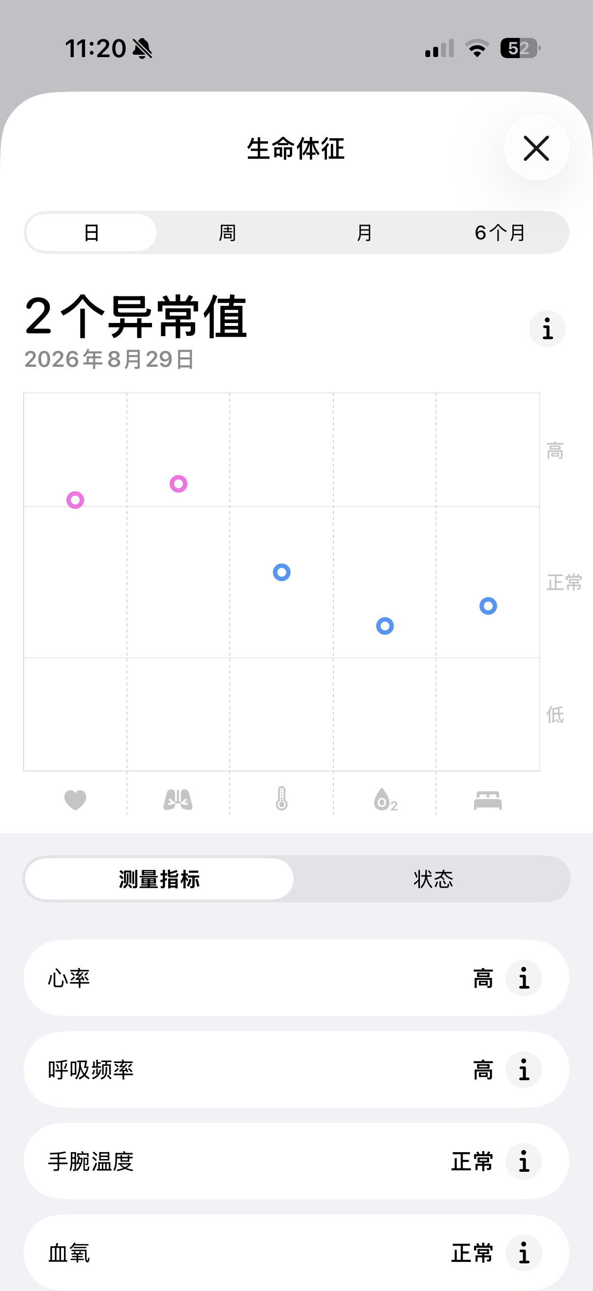 手表直接给我弹了两个异常值，刚看到的时候还是觉得还是真吓人[淡淡的]但打开一看发