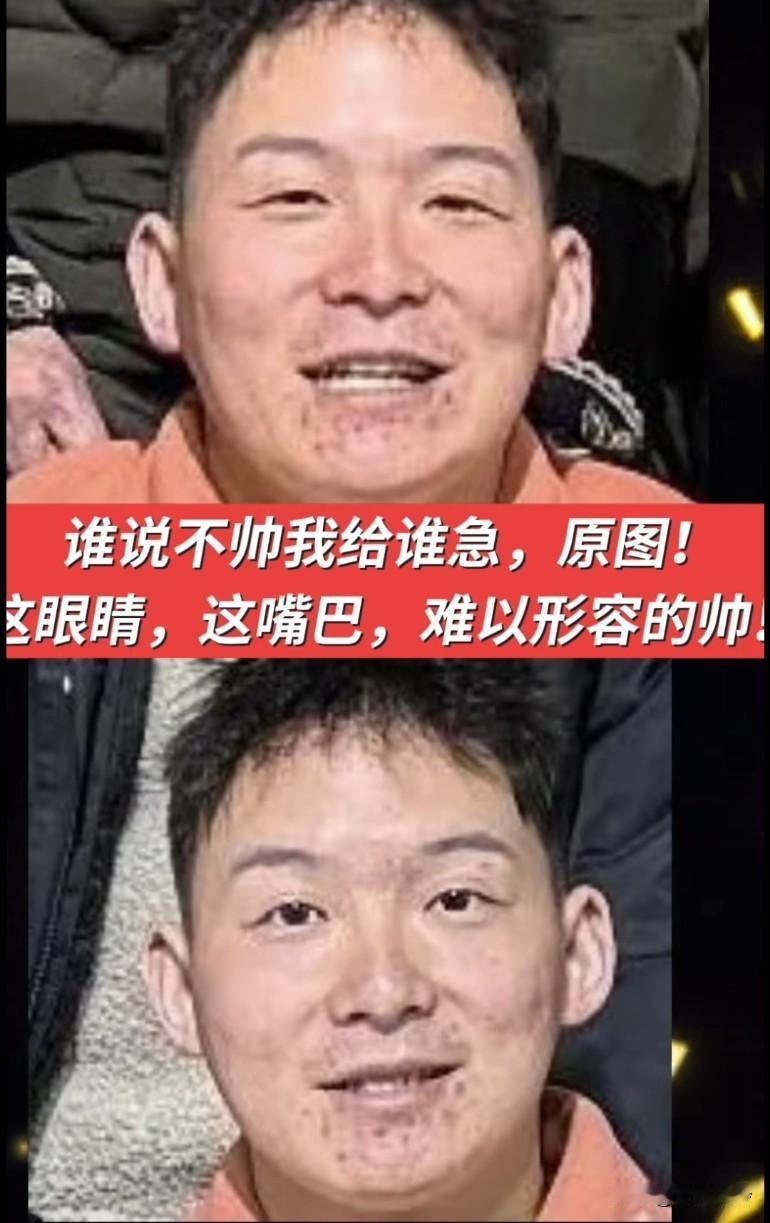 不是认亲返校后，妹妹给带去了去痘的产品了吗？怎么感觉越来越严重了！有钱后吃成这样
