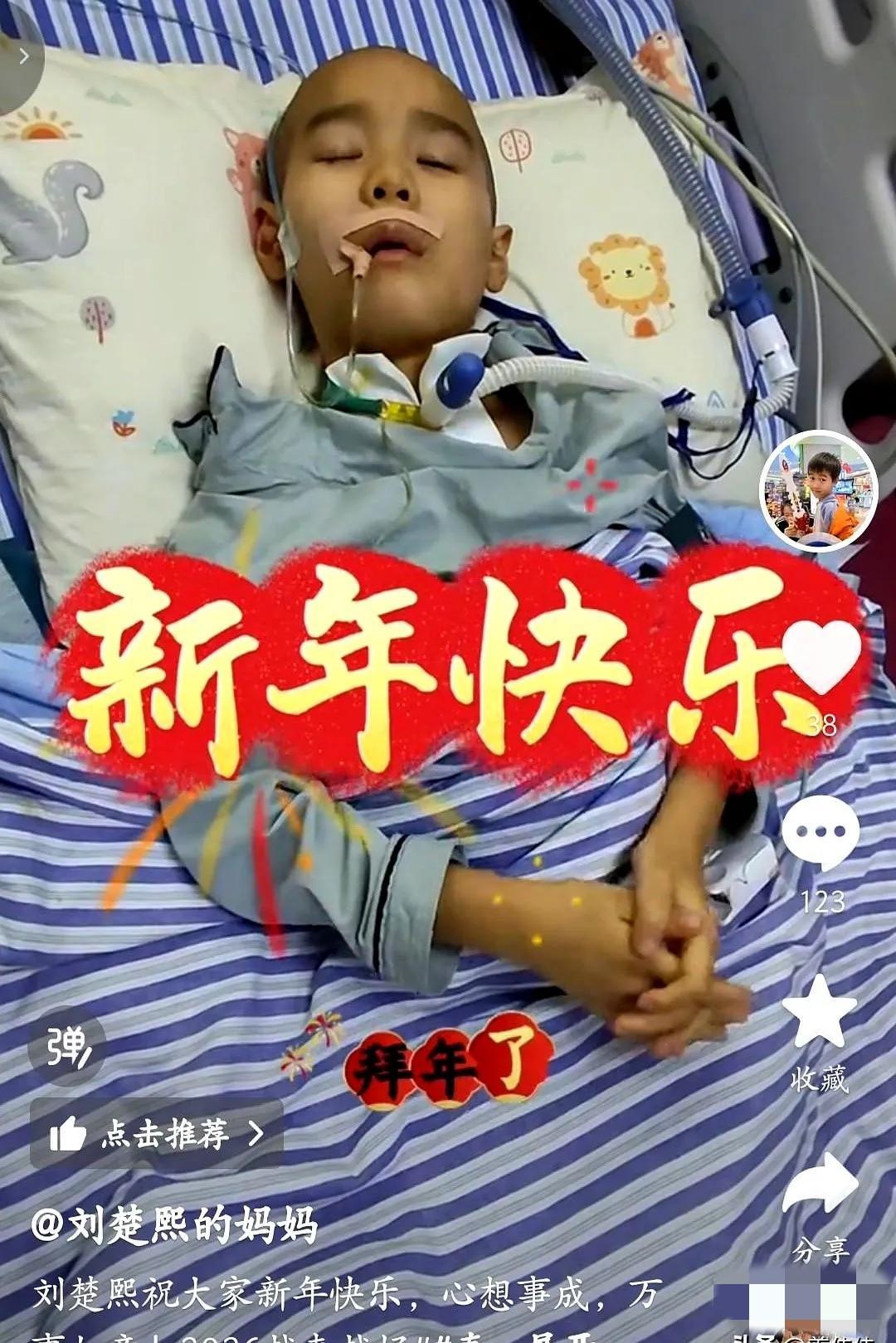 刘楚熙，除夕夜终于能睁开左眼了，刘妈妈分享了视频。
孩子的精神头虽然不太足，但还