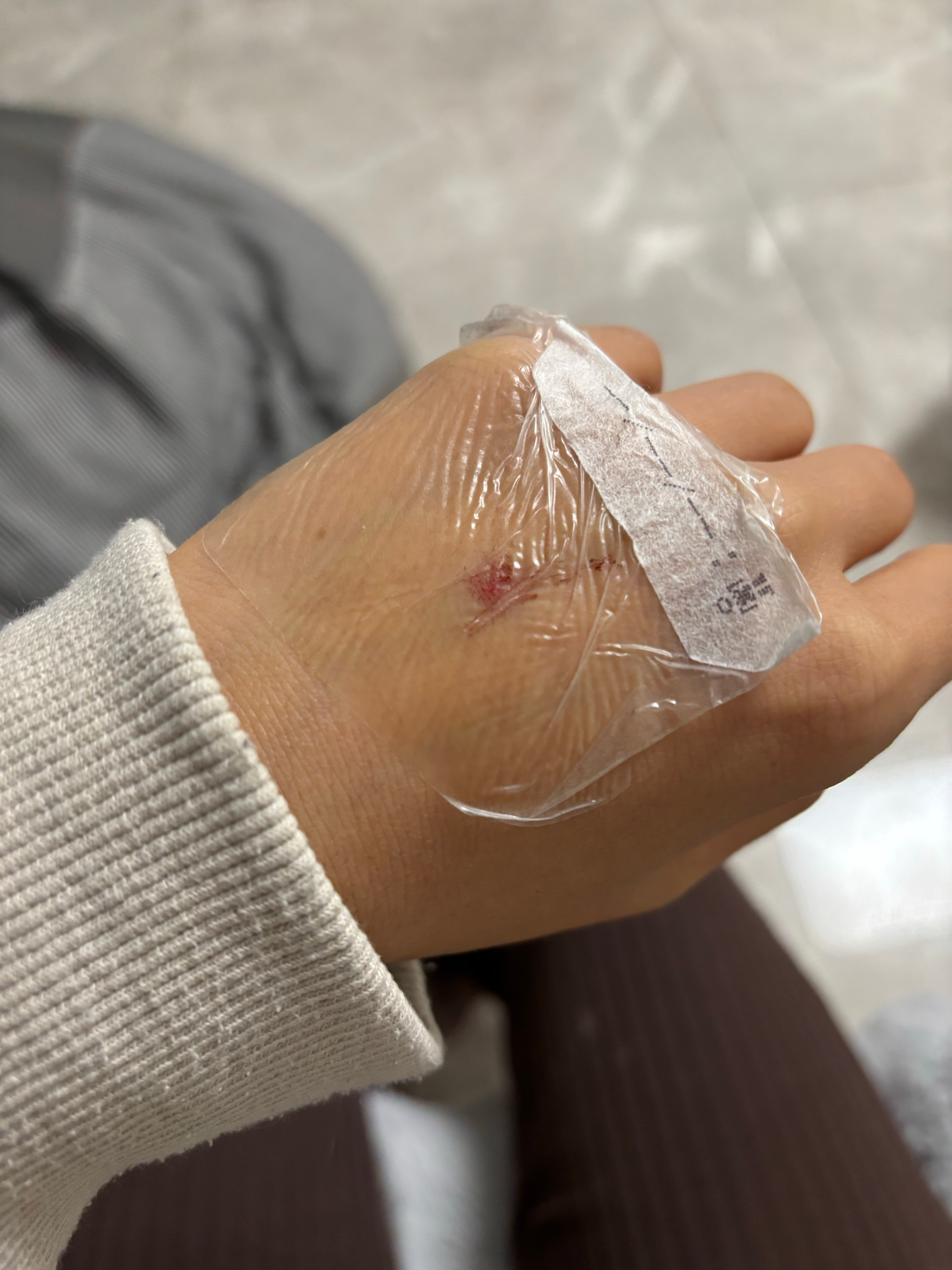这么粗的针头，我只在小时候看兽医给牛打针见过，以后不想再看见留置针了。谢谢跳跳小
