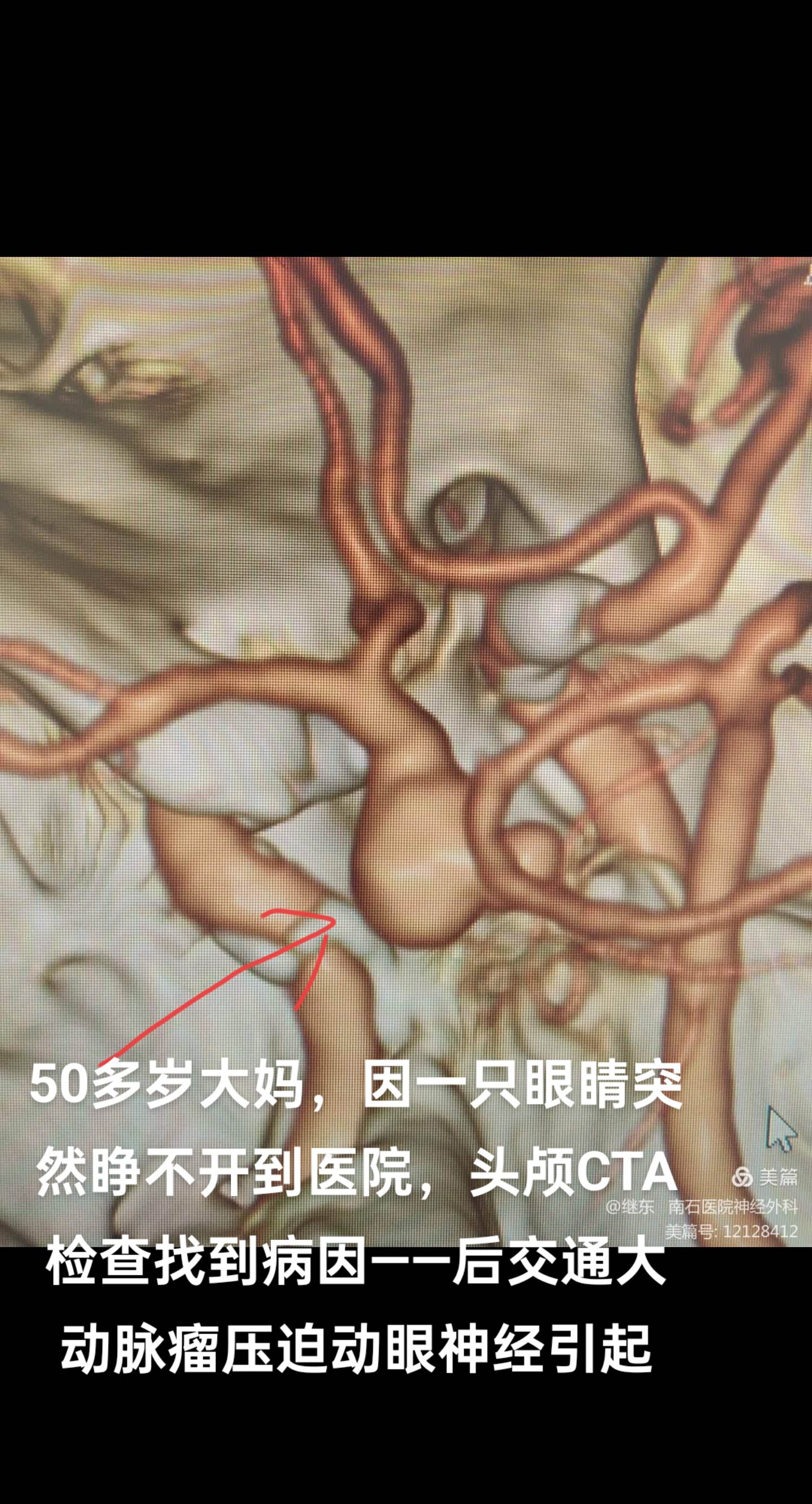 医学科普 医生日常
