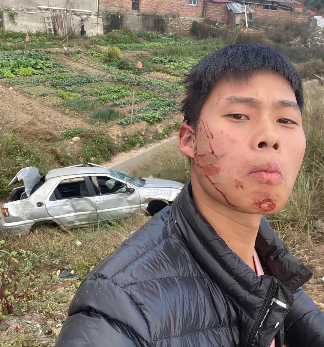 几百万的豪车就这么报废了，好心痛​​​。 ​​​