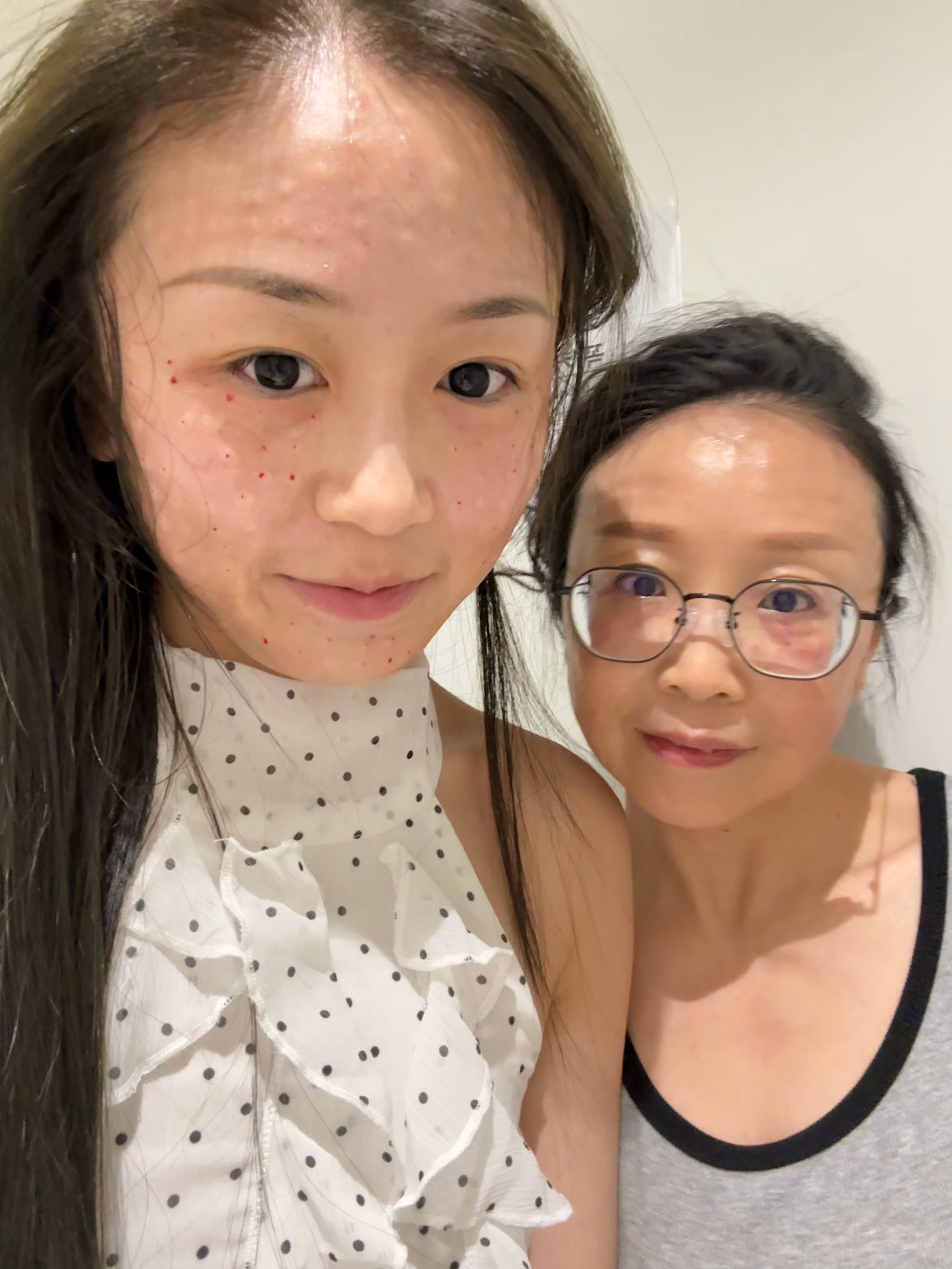 非常怕痛所以吃了两颗半止痛药才敢打丽珠兰红盒(ﾟoﾟ;; 