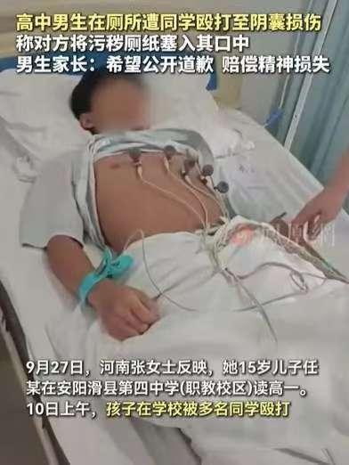 河南安阳15岁高一男生小任，因提醒对门宿舍安静遭十余人围殴，被打至满嘴流血、多处