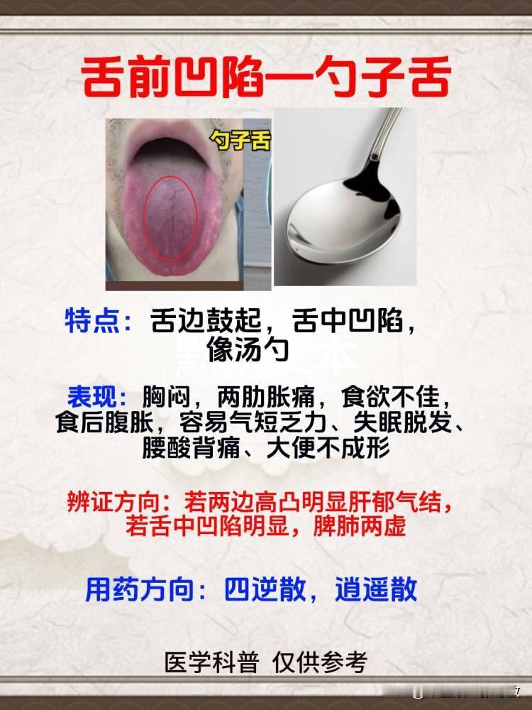 睡眠差，总脱发，肾气不足还拉肚[灵光一闪][灵光一闪]
舌头这3种形状要注意了！