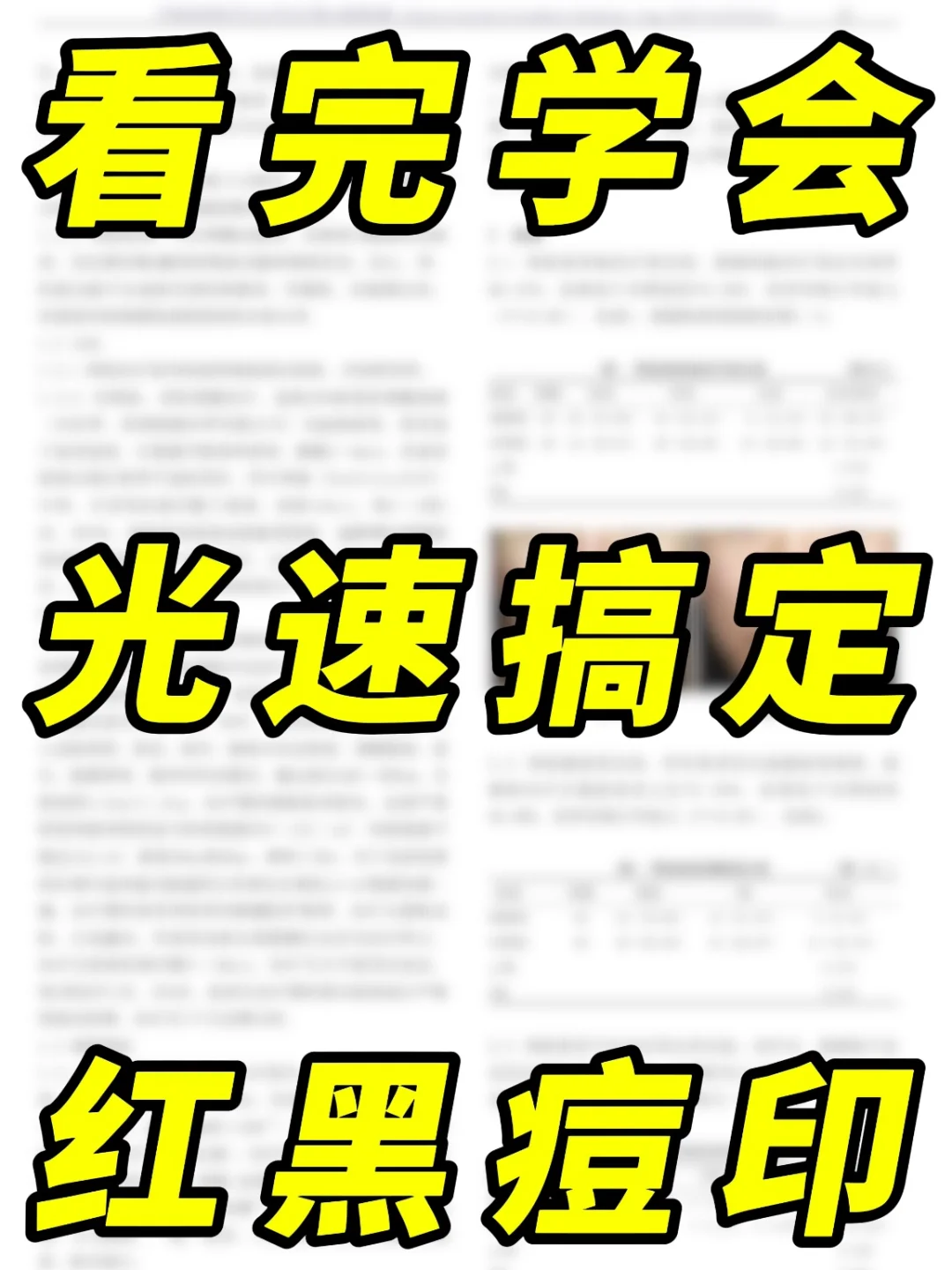 痘印终结者！无瑕匀净好皮肤就是：爽！