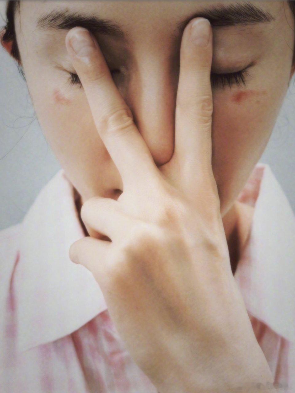 杨幂脸被蒸汽眼罩烫伤了烫伤不会留疤吧？ 