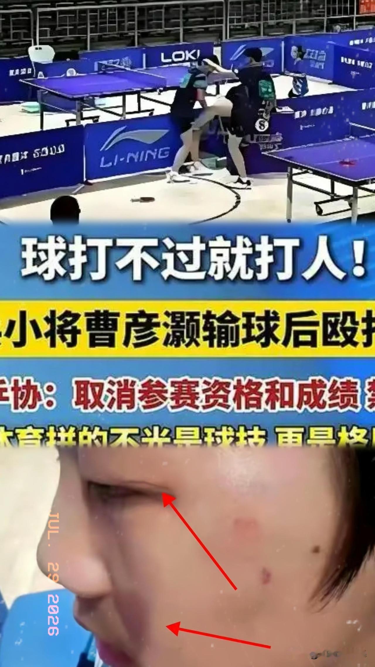 曹彦灏这事儿，
看得人心里发慌，
14岁的少年，球场上输红了眼，直接给对手一拳，