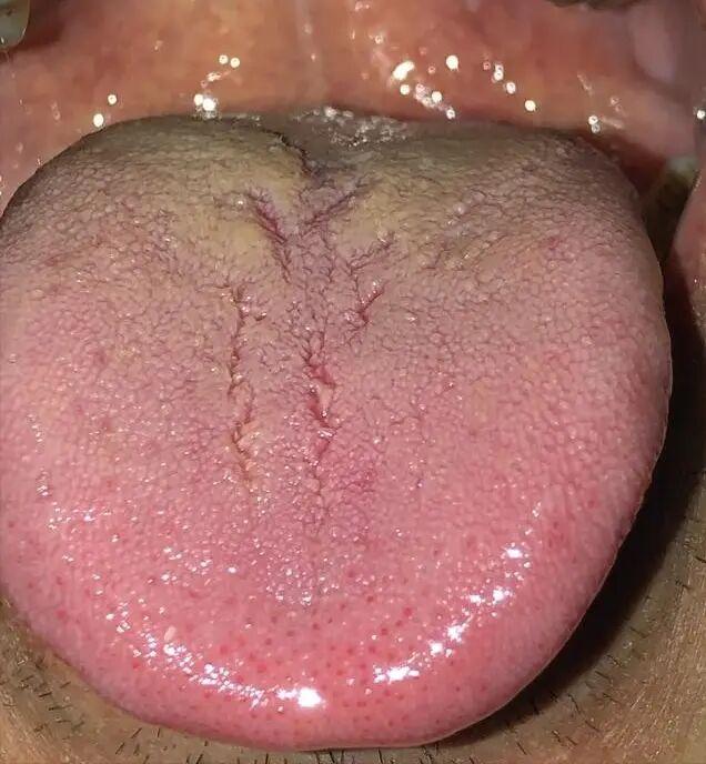 男性健康问题：夜晚性欲旺盛但时间短暂
患者自述：年纪轻轻，仅30岁，但已感到性能