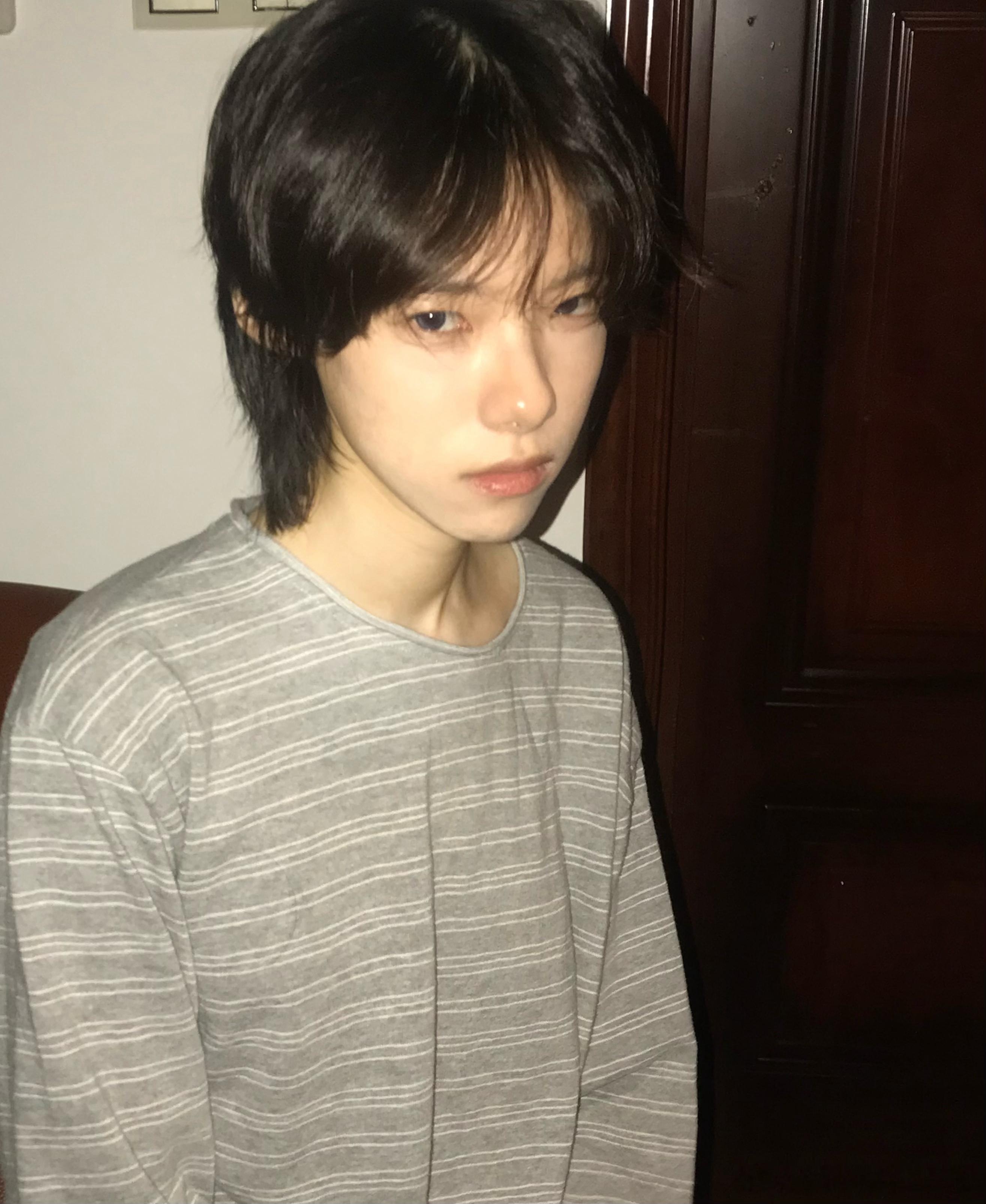 恭喜张乐头发长出来了一些[老师好][老师好][老师好] ​​​