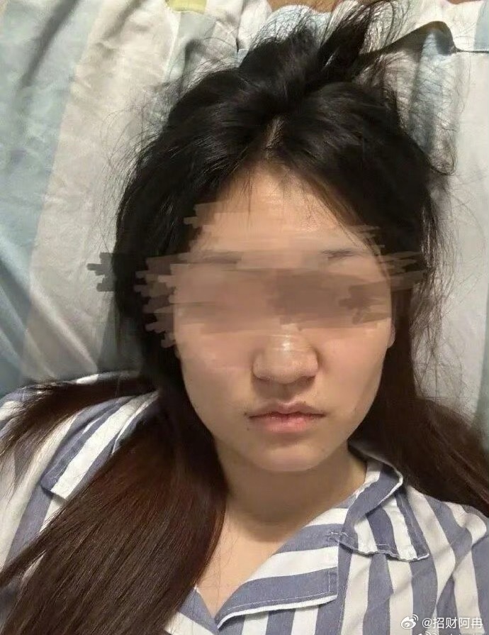 公厕被殴案施暴男子已出狱曾引发全网关注的浙江永康公厕被殴打案件，施暴者俞某已经刑