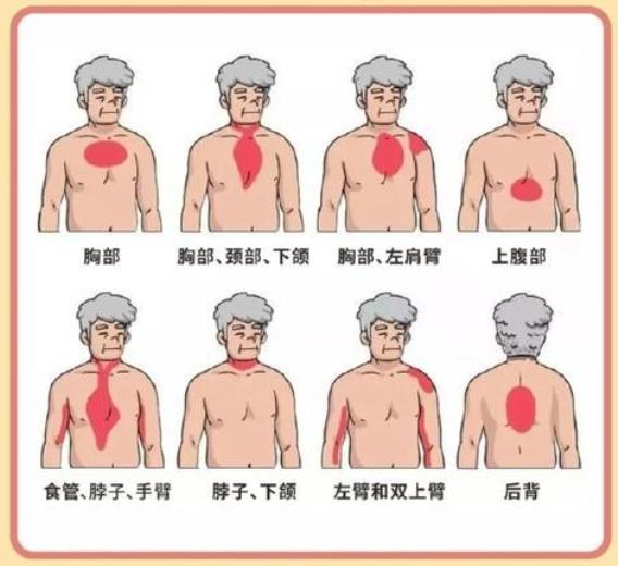 心梗的12种预兆，请牢记！
1. 头晕
2. 脐周疼痛
3. 脚底疼痛
4. 睁