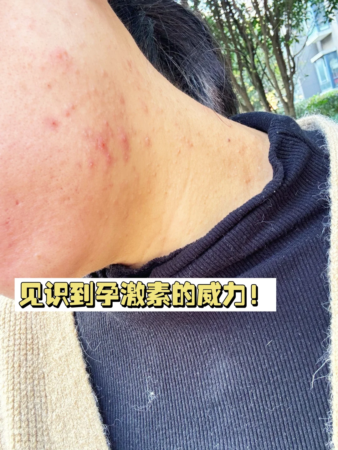 千万别像我，到孕晚期才知道孕期护肤多重要！