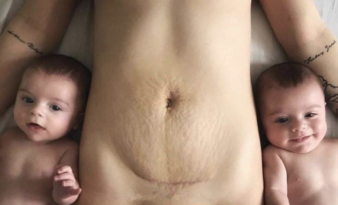 母爱的力量为所有妈妈和自己的勇敢付出点个赞吧