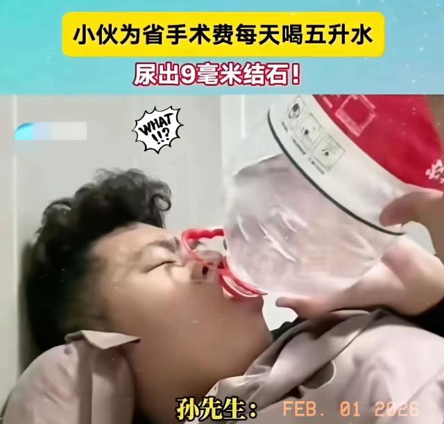 真是一个狠人啊！小伙为了省12000手术费，每天喝五升水，结果尿出9毫米结石！小