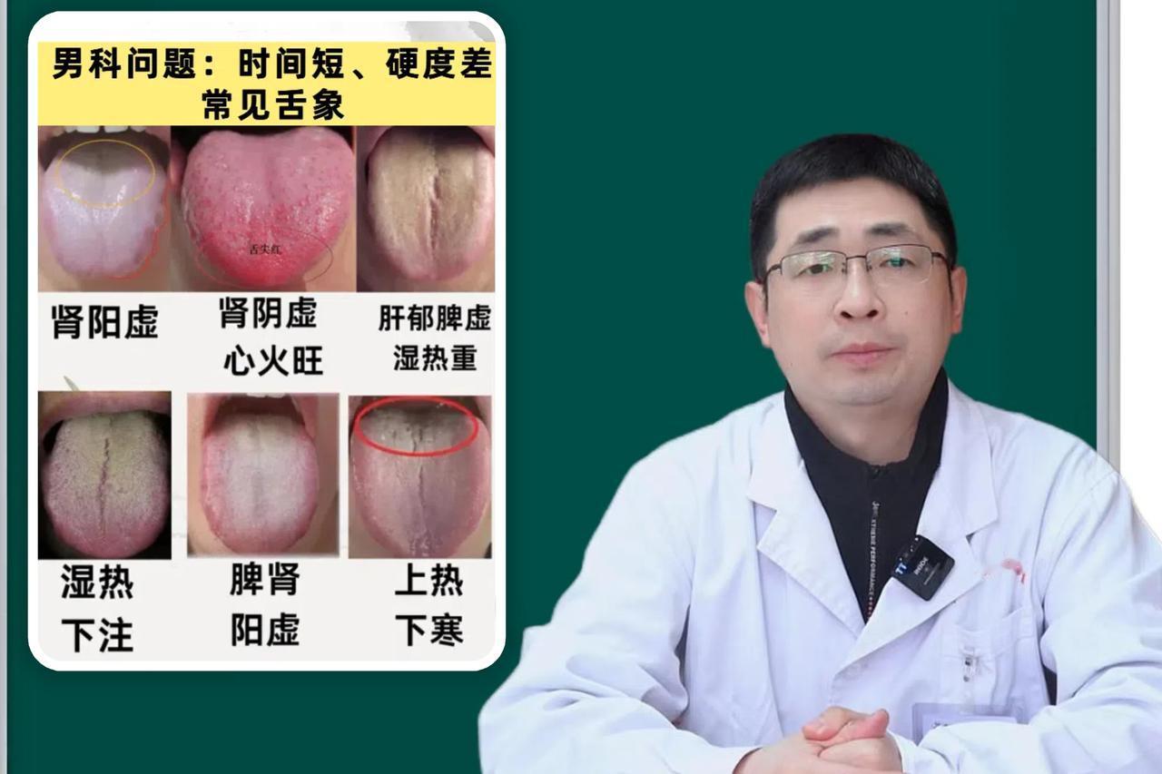 这个月每日坚持抽空看舌象第13天，今天争取看完88个舌象！

应粉丝要求我又来帮
