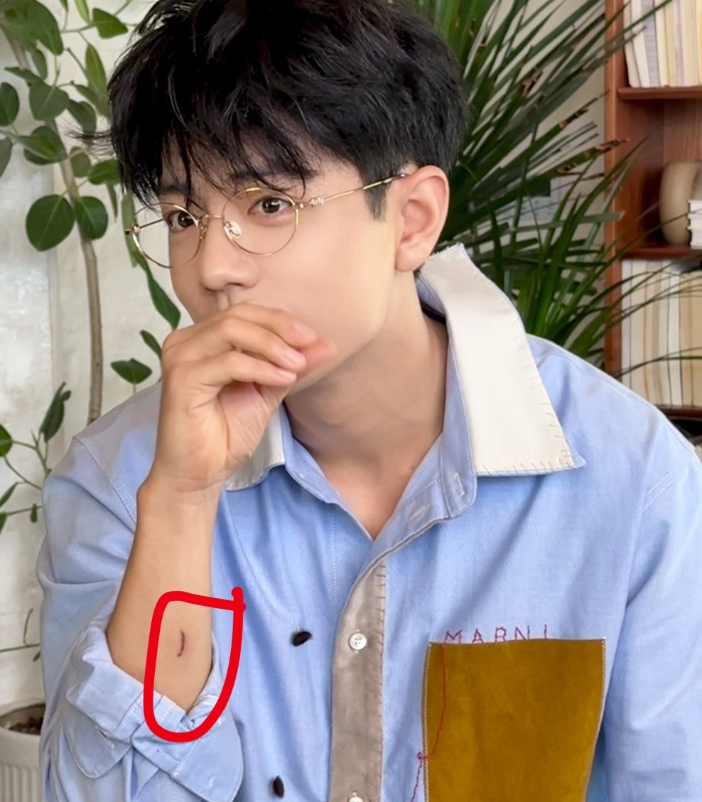 肖战手上有个挺大的伤口[思考] 工作室发图片的时候p掉了！肖战工作室仪式感 ​​