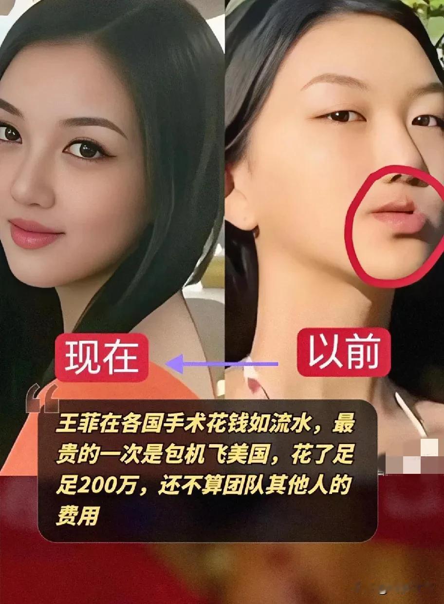 李嫣兔唇修复成功，王菲的母爱与巨额投入令人动容，看到李嫣自信又耀眼，母爱真是最好