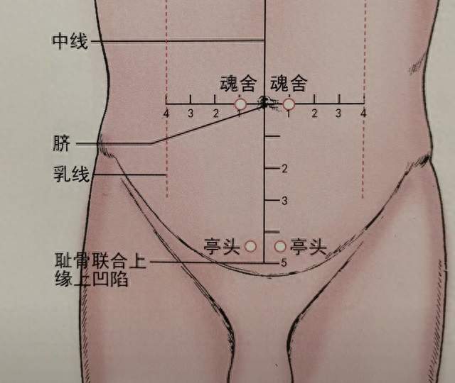 我压力一大就拉肚子，查了三年没大病，最后在肚脐旁边找到答案