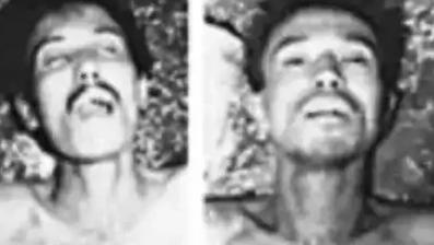 1983年，“悍匪”王宗坊被击毙后蜷缩在地上，他的身体瘦得皮包骨头，胃里几乎没有