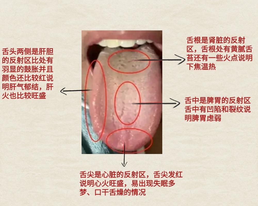 今日份患者舌象案例分析。#辨舌象知健康#