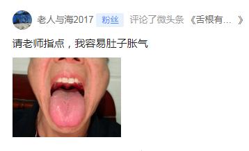 来看看这个留言的舌象
主诉肚子胀气，我们说肚子胀一般是脾胃的气机升降有问题，左升