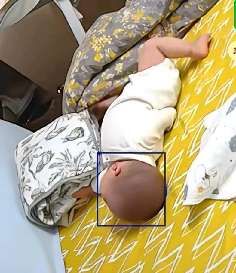 宝宝在床上翻身时，把胳膊压在身下，竟然脱臼了，
没想到小宝宝自主翻身还可以吧，胳