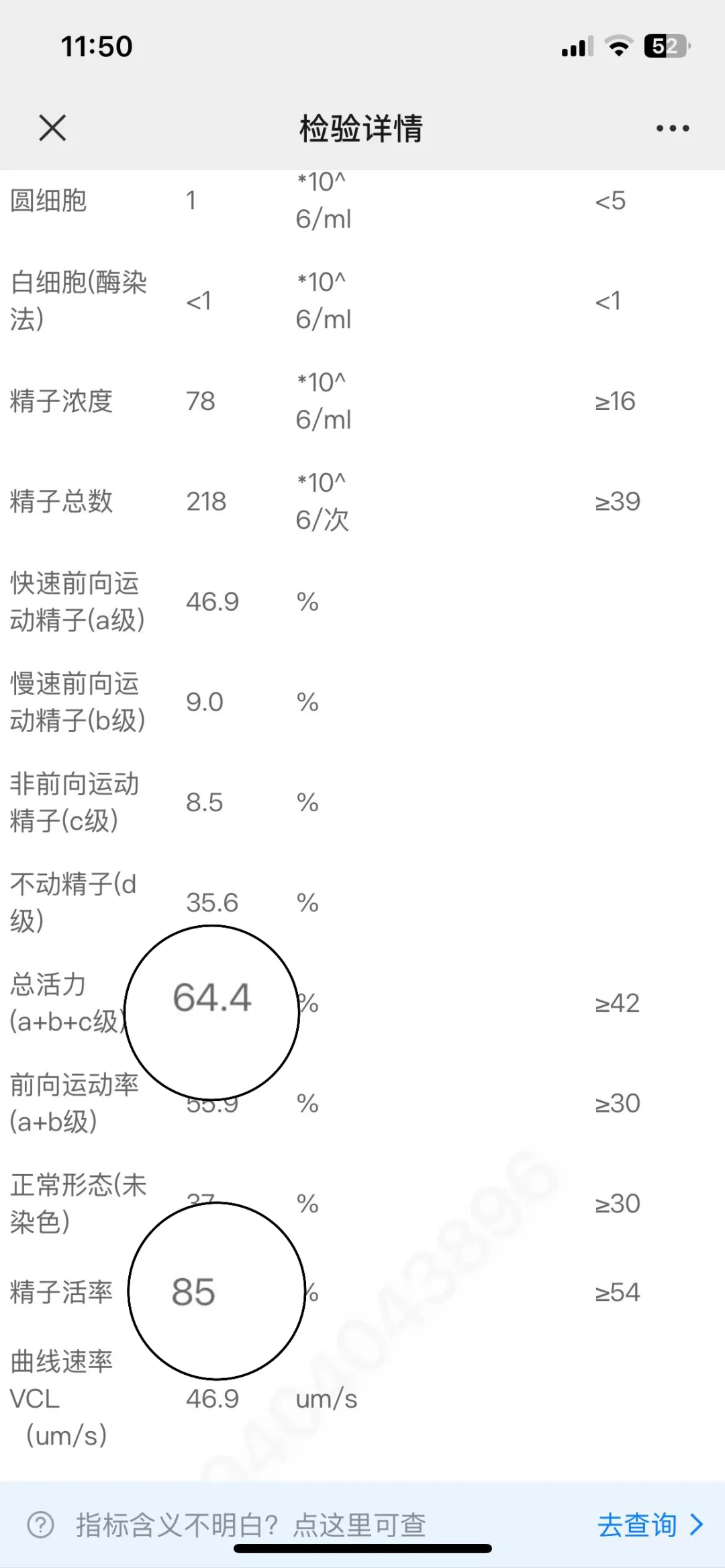 姐妹们，孕前检查老公这样正常吗