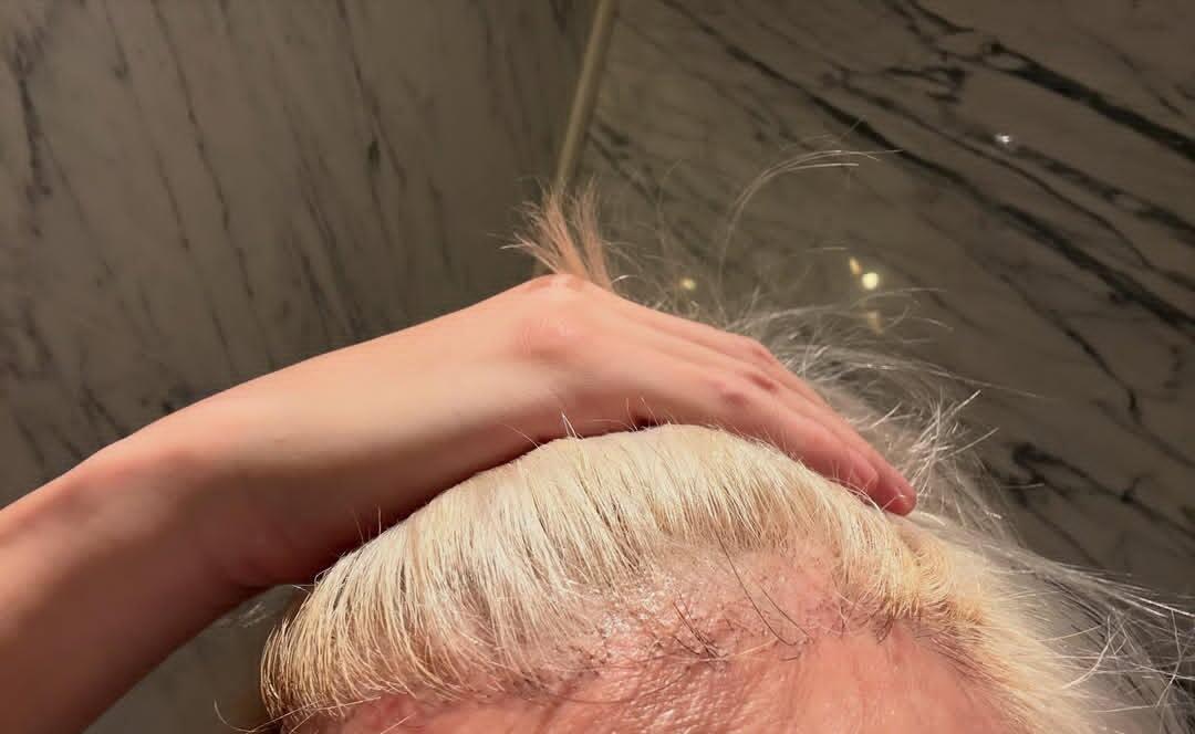 薛之谦满头斑秃和水泡妈呀 