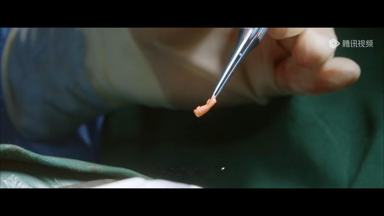 问心林逸周筱风一早就告诉彭茂家属了，老爷子有很严重的基础病，冠心病血管还堵得那么