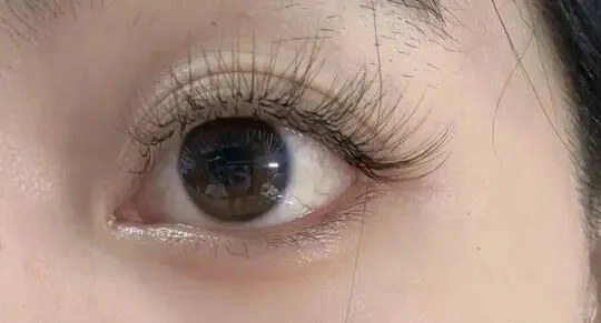 高度近视打工人，分享干眼好转的几个习惯