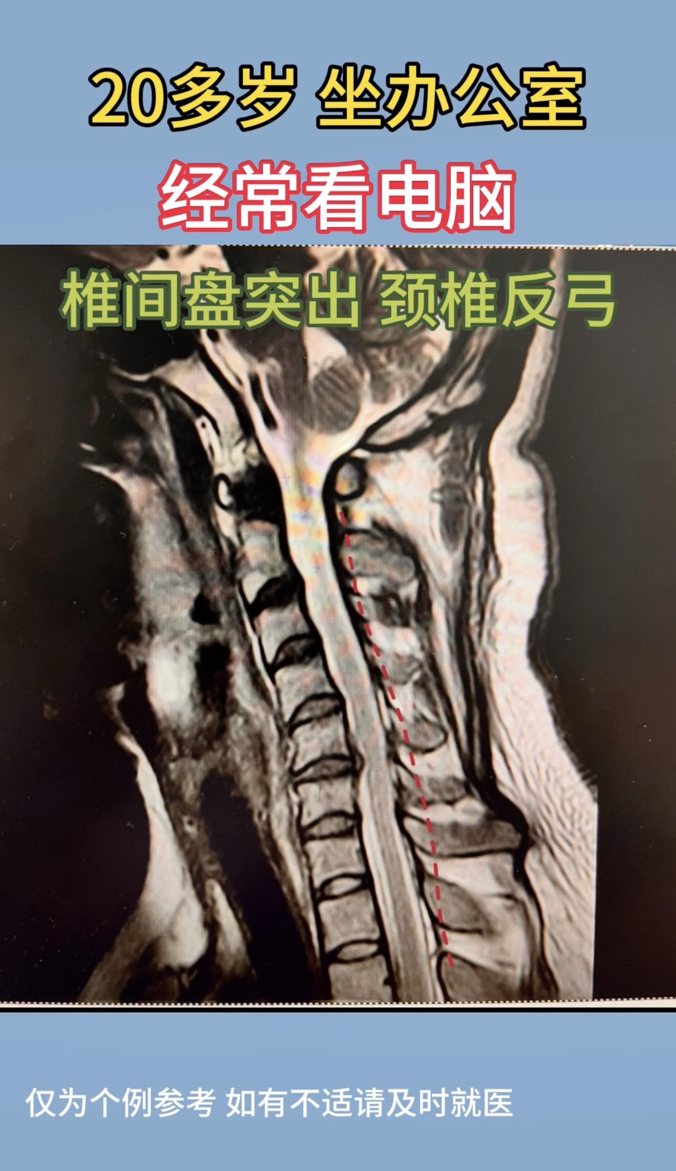 当“牛马”可以！但我们要当健康的“牛马”