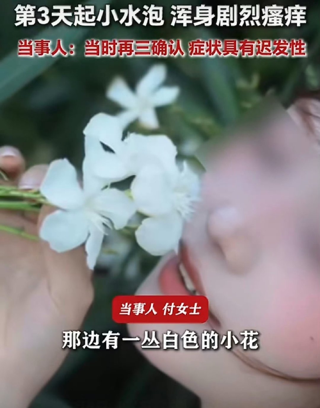 夹竹桃有毒是常识还要含着嘴里拍照，为了几张照片折腾到过敏中毒。女生嘴含夹竹桃拍照