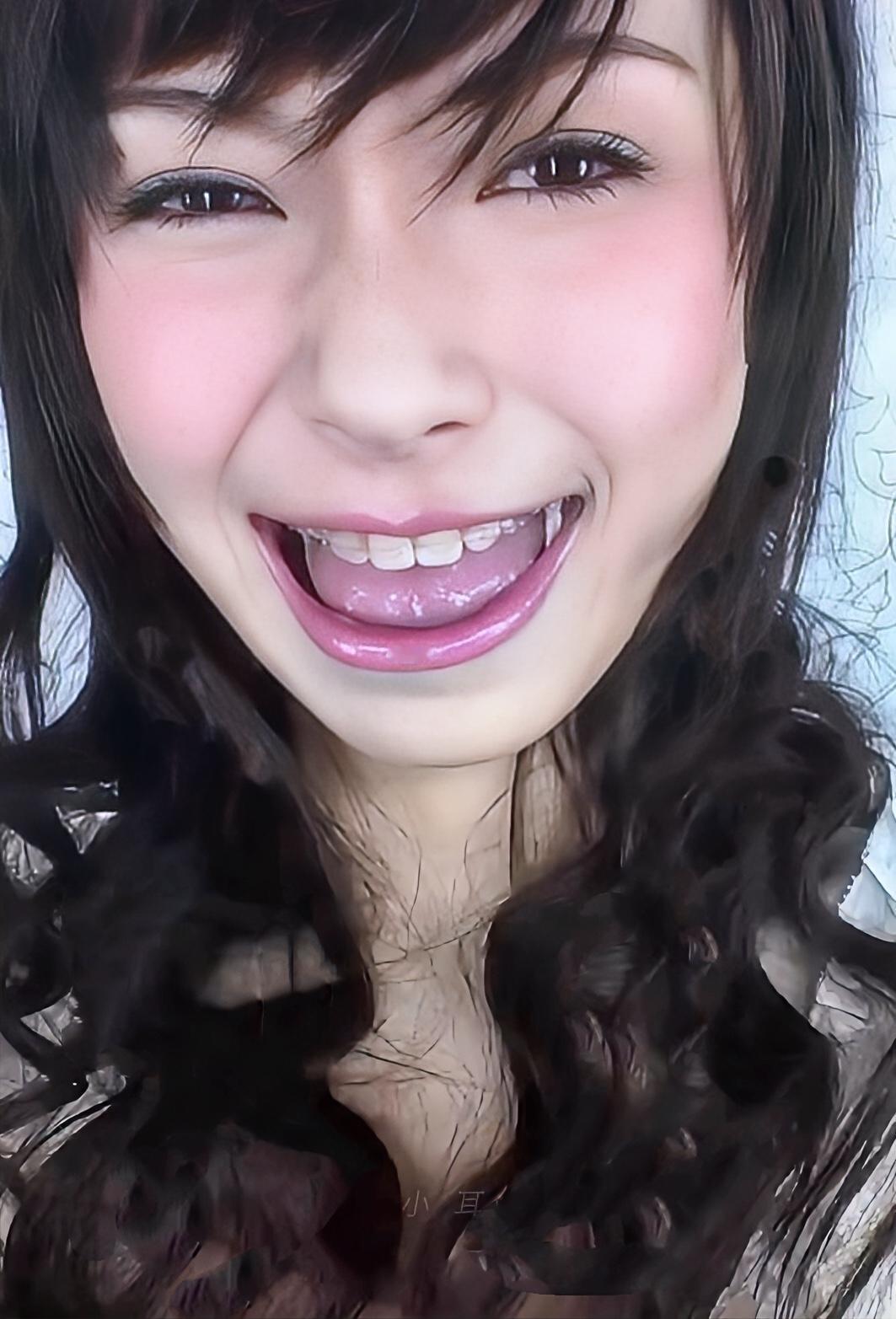 牙齿做了变化真的很大  娱乐