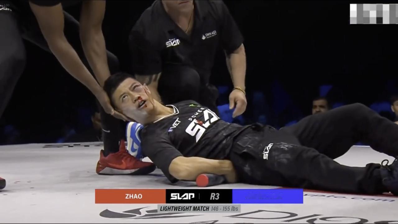 赵鸿刚真乃硬汉也，世界扇耳光大赛被人击晕倒地只是轻微伤！

10月31日，赵鸿刚