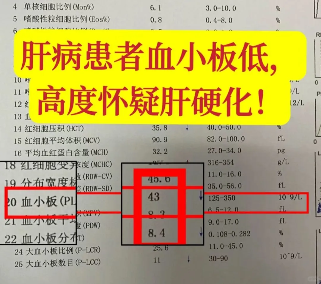 血常规与肝硬化有什么关联？