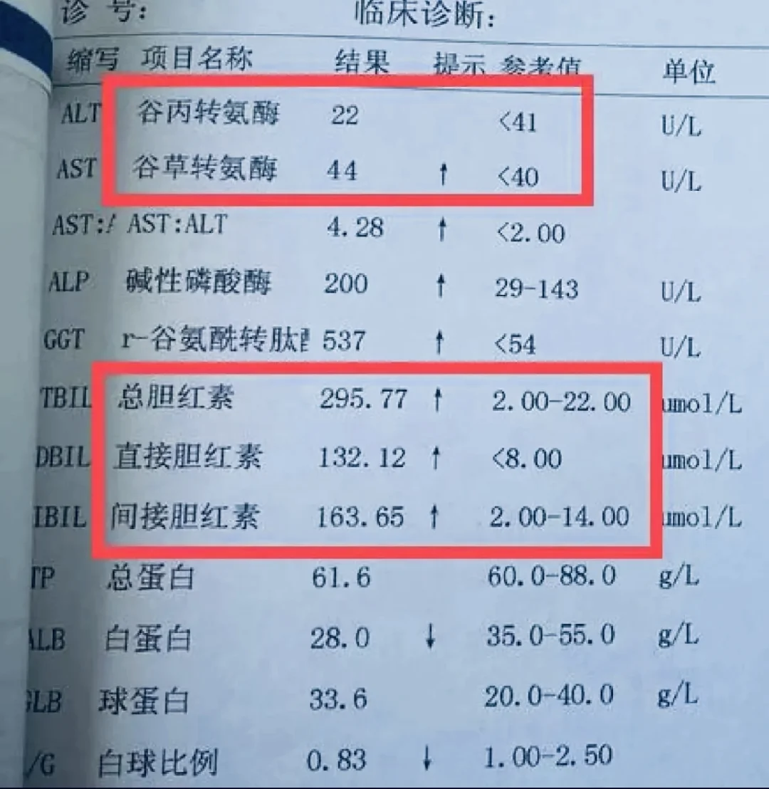 希望你的体检报告，这2项指标永远不会升高 门诊上经常碰到患者拿着肝功能...
