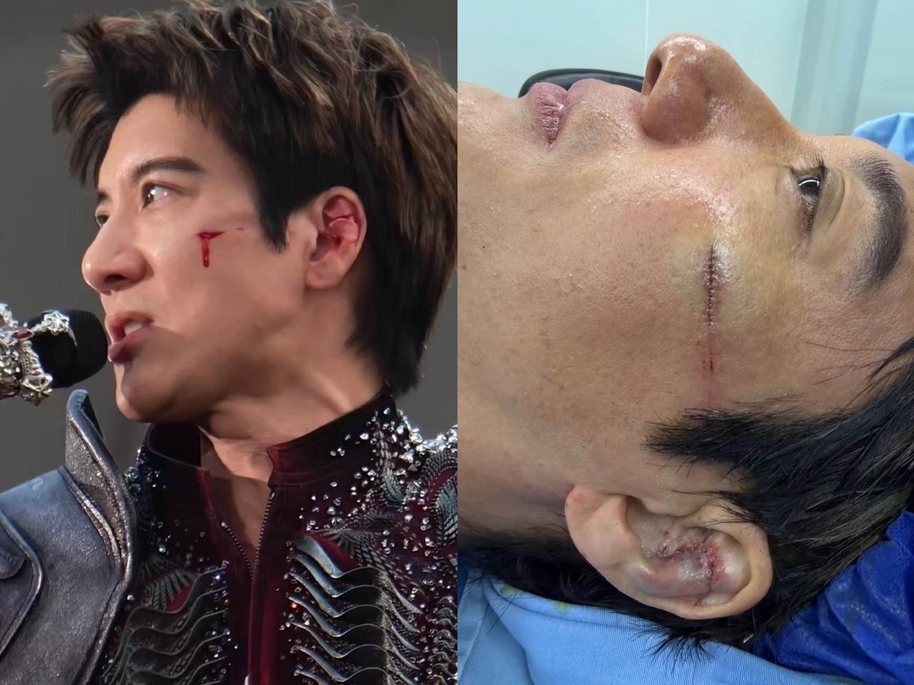 我觉着王力宏往后恐怕很难再结婚啦！
为啥这么说呢？
可不是因为

他这次演唱会脸